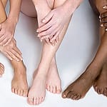 laser hair removal before and after legs