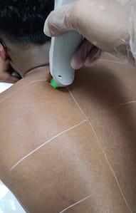 Men back & shoulders permanent