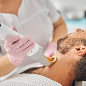 beard laser hair removal