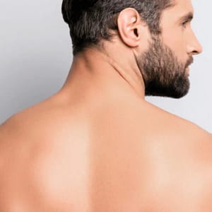 Men back shoulder laser hair removal