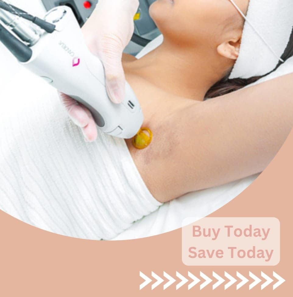 Female underarms Laser hair removal service