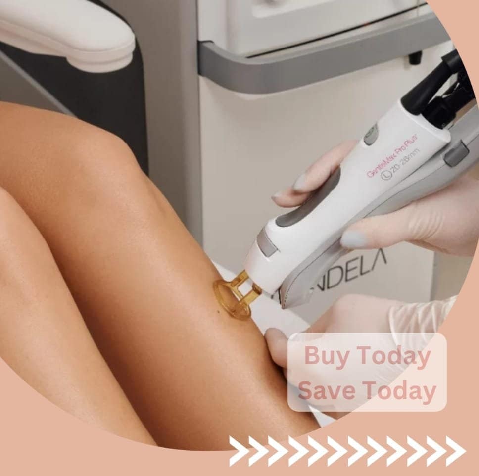Full legs Laser hair removal Clinic