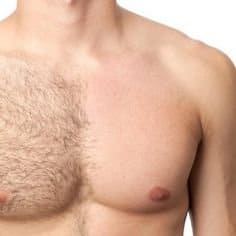 Men Chest & abdomen Laser Hair Removal